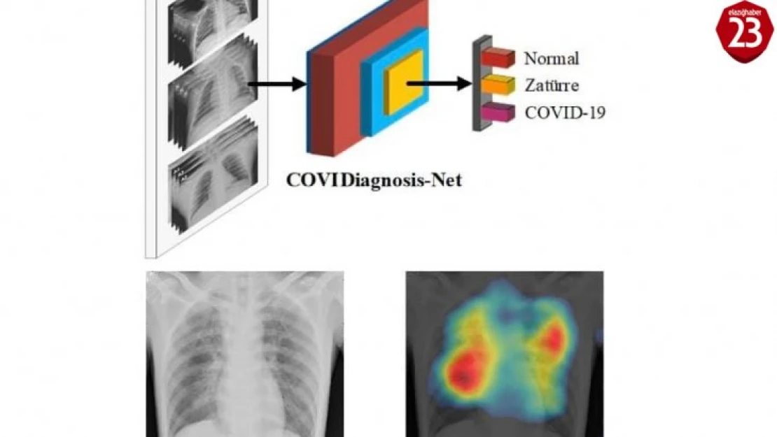 Korona virüs teşhisini kolaylaştıracak yapay zeka sistemi