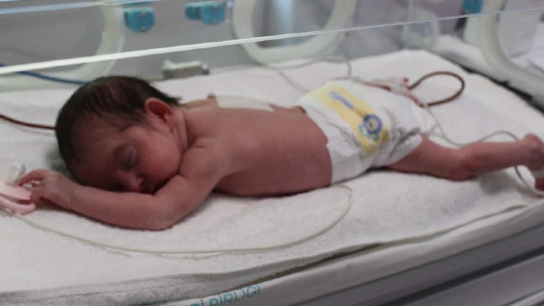 Doktorlar Yeni Doğan Bebeğe Öyle Bir Şey Yaptılar Ki, Elazığ'da İlk