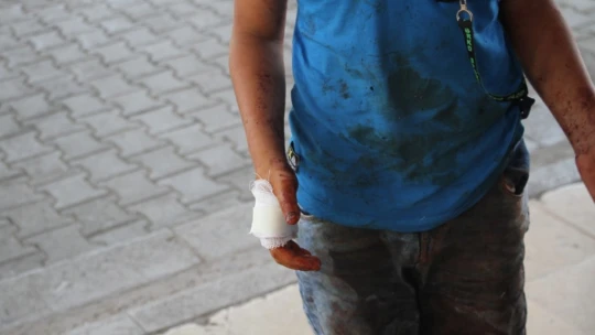 Babasına Kurban Kesmek İçin Yardım Eden Çocuk Elini Kesti