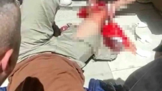 Elazığ'da silahlı kavga: 1 yaralı