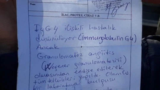 İmmünglobülin G4 hastalığına yakalanan Ayşe, Türkiye'de 2, dünyada 13'üncü vaka oldu