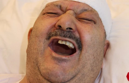 Diş Ağrısı Sanıp 6 Sağlam Dişini Çektirdi, Meğer Gerçek Bambaşka Çıktı