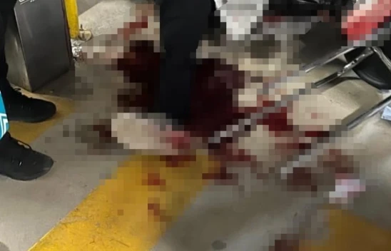 Elazığ'da AVM Otoparkında Bıçaklı Kavga: 1 Yaralı