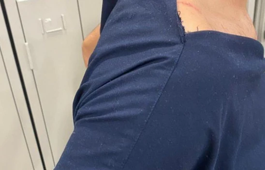 Elazığ'da hemşire, hasta yakınları tarafından darp edildi