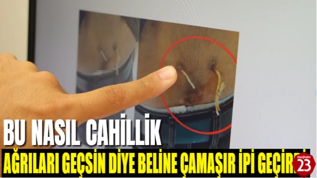 Bu Nasıl Cahillik Ağrıları Geçsin Diye Beline Çamaşır İpi Geçirmiş